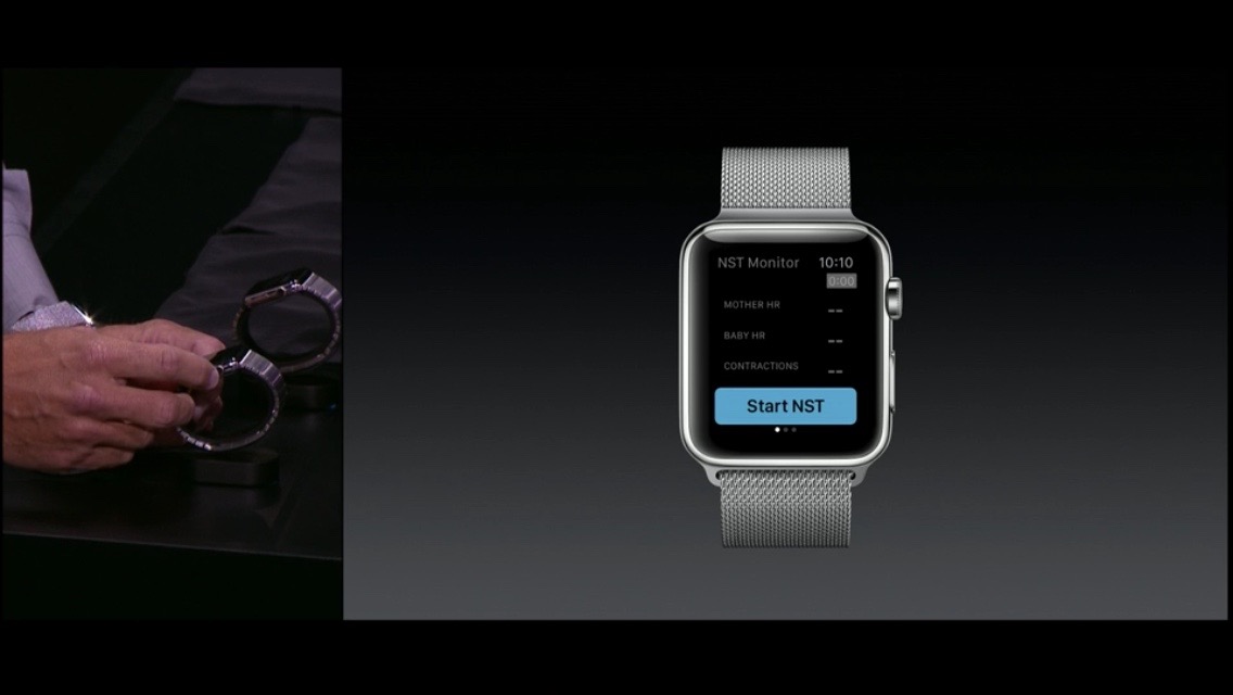 Apple Watch AirStrip