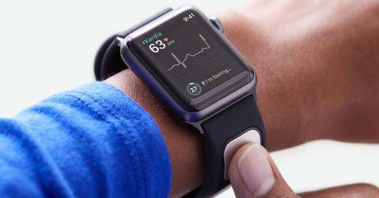 smartwatch on wrist closeup