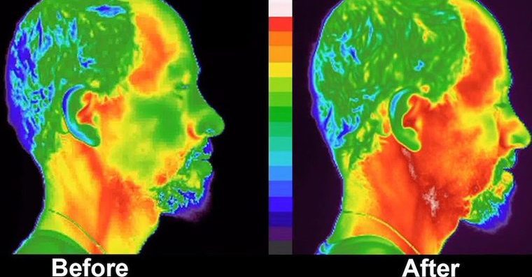 thermal image before after