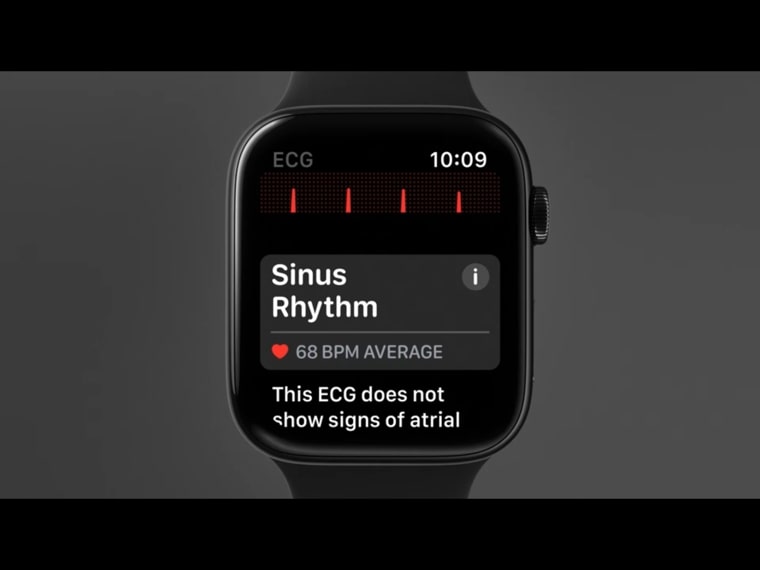 smartwatch ecg display