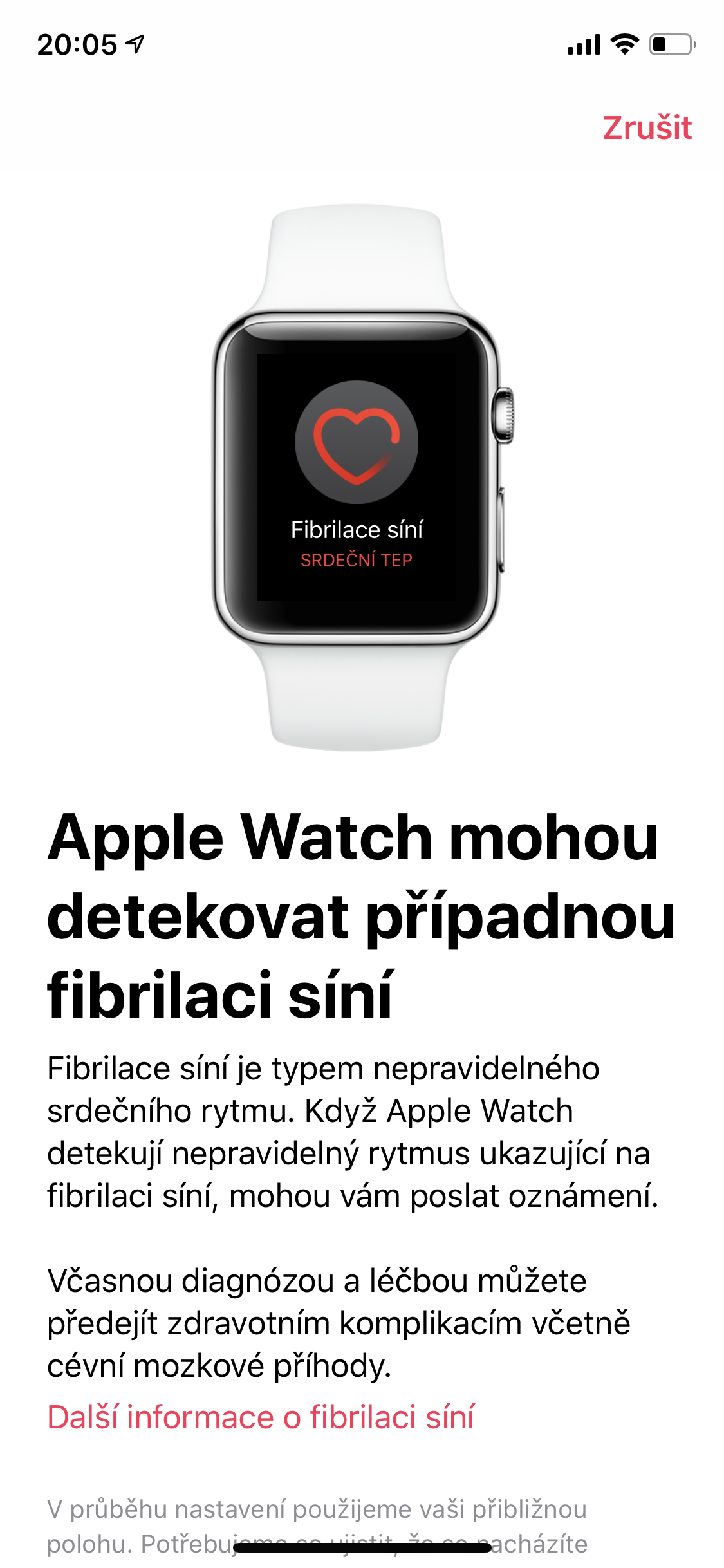 apple watch heart monitor