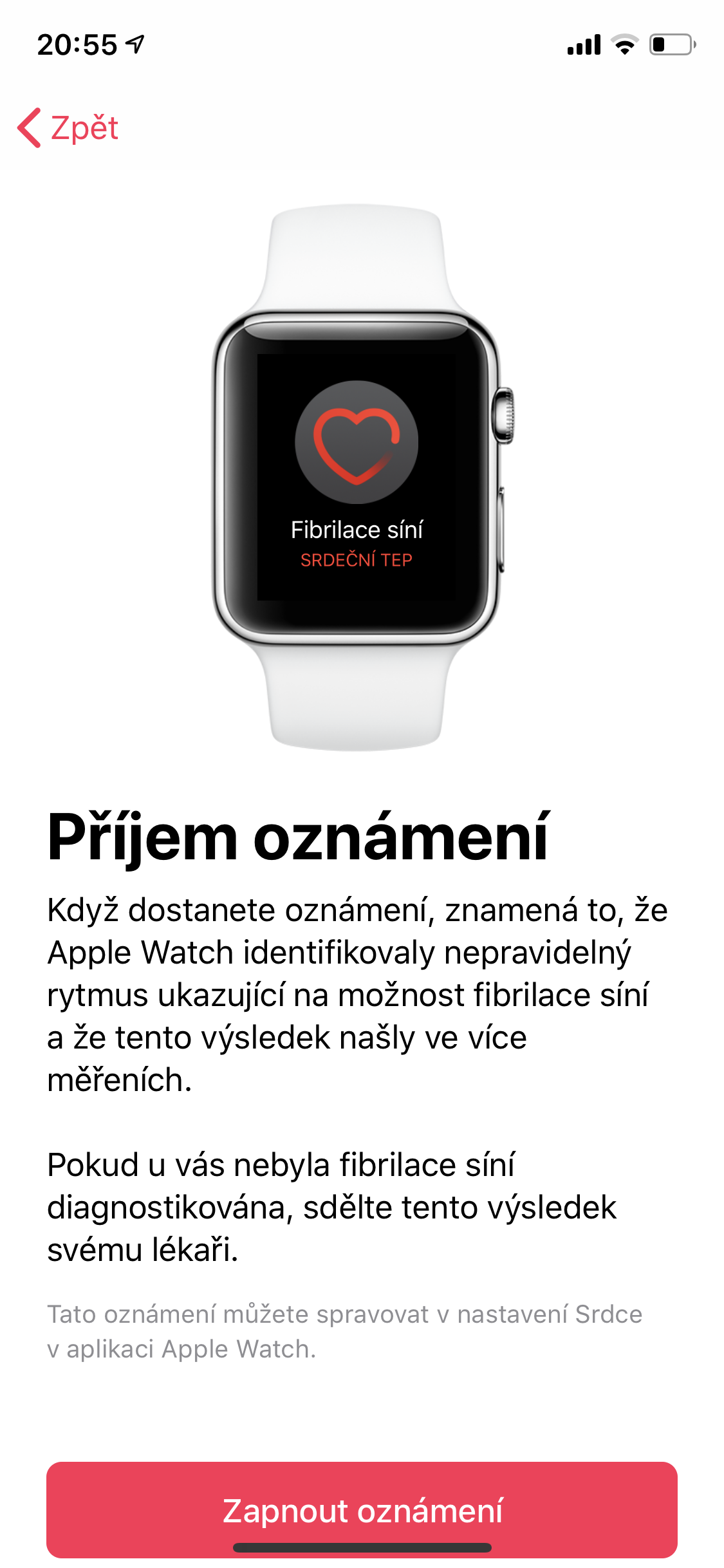 apple watch notification