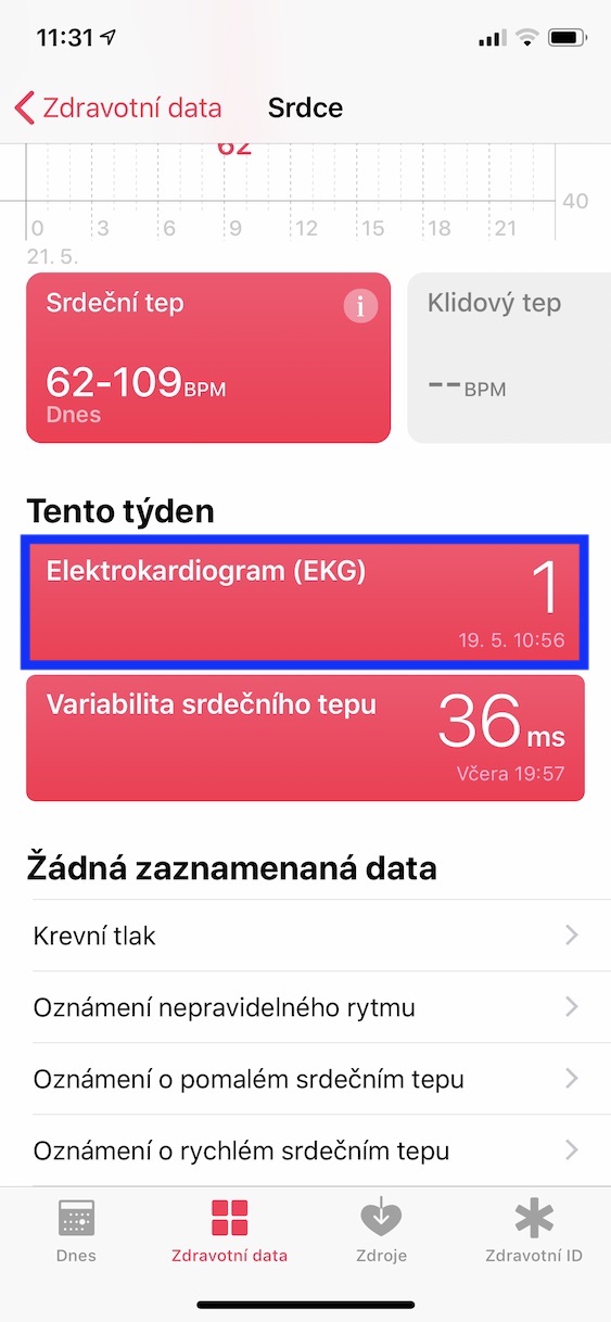 export_pdf_ekg1