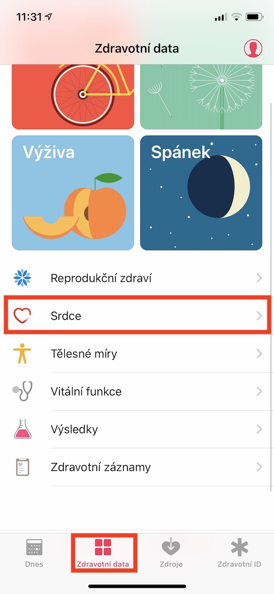 export_pdf_ekg2