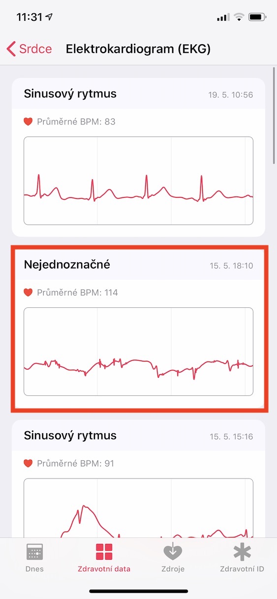 export_pdf_ekg3