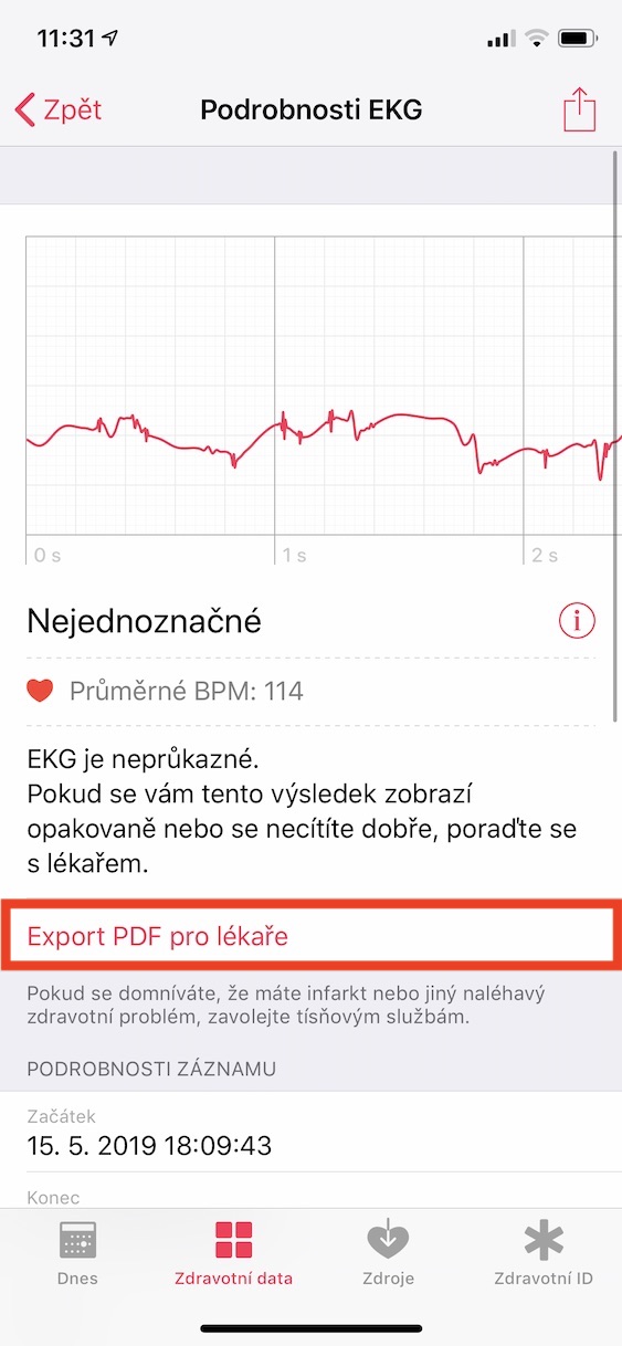 export_pdf_ekg4