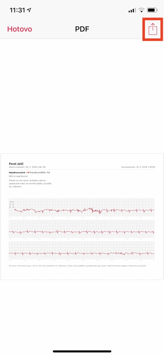 export_pdf_ekg5