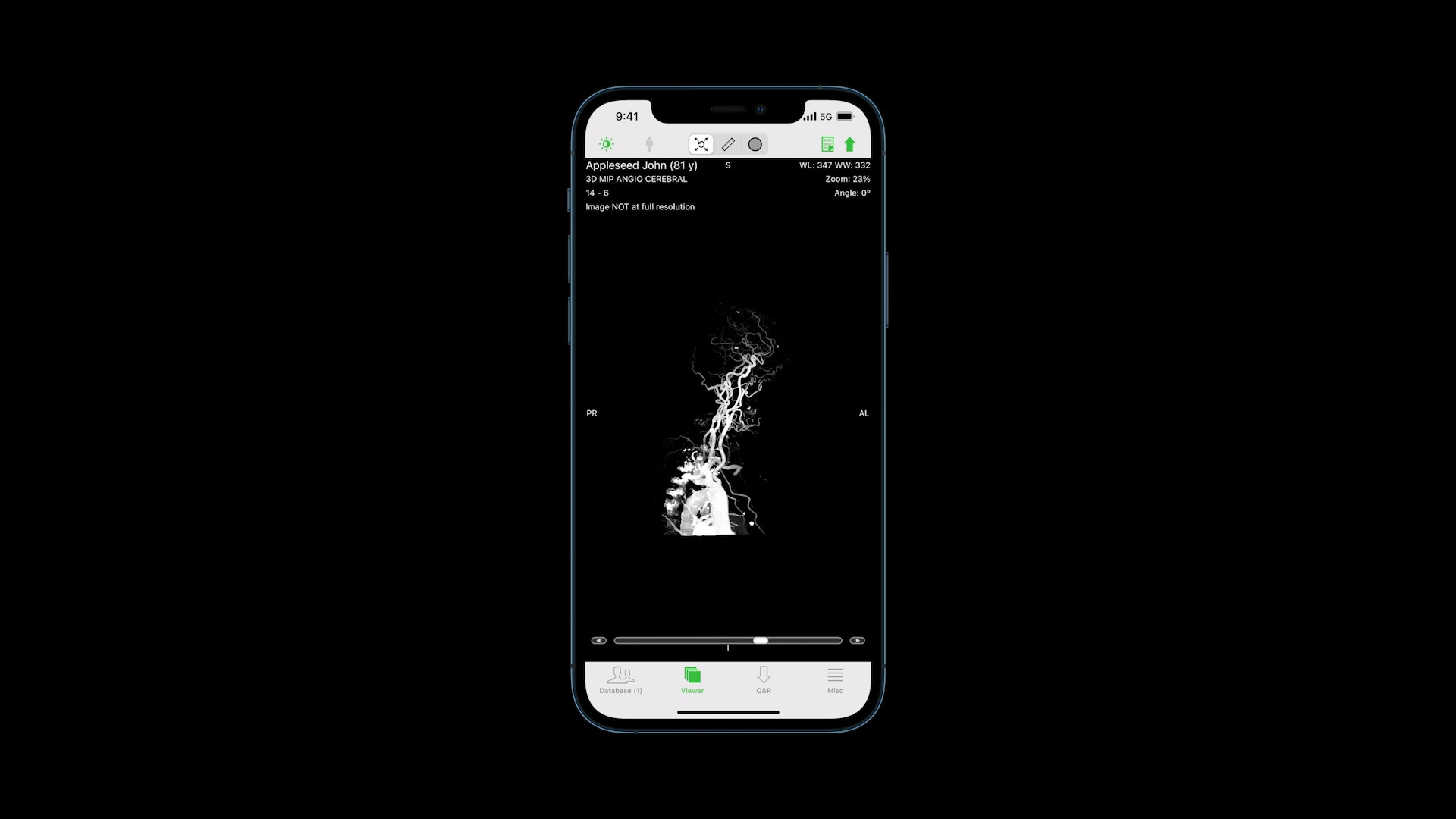 iphone screen medical image