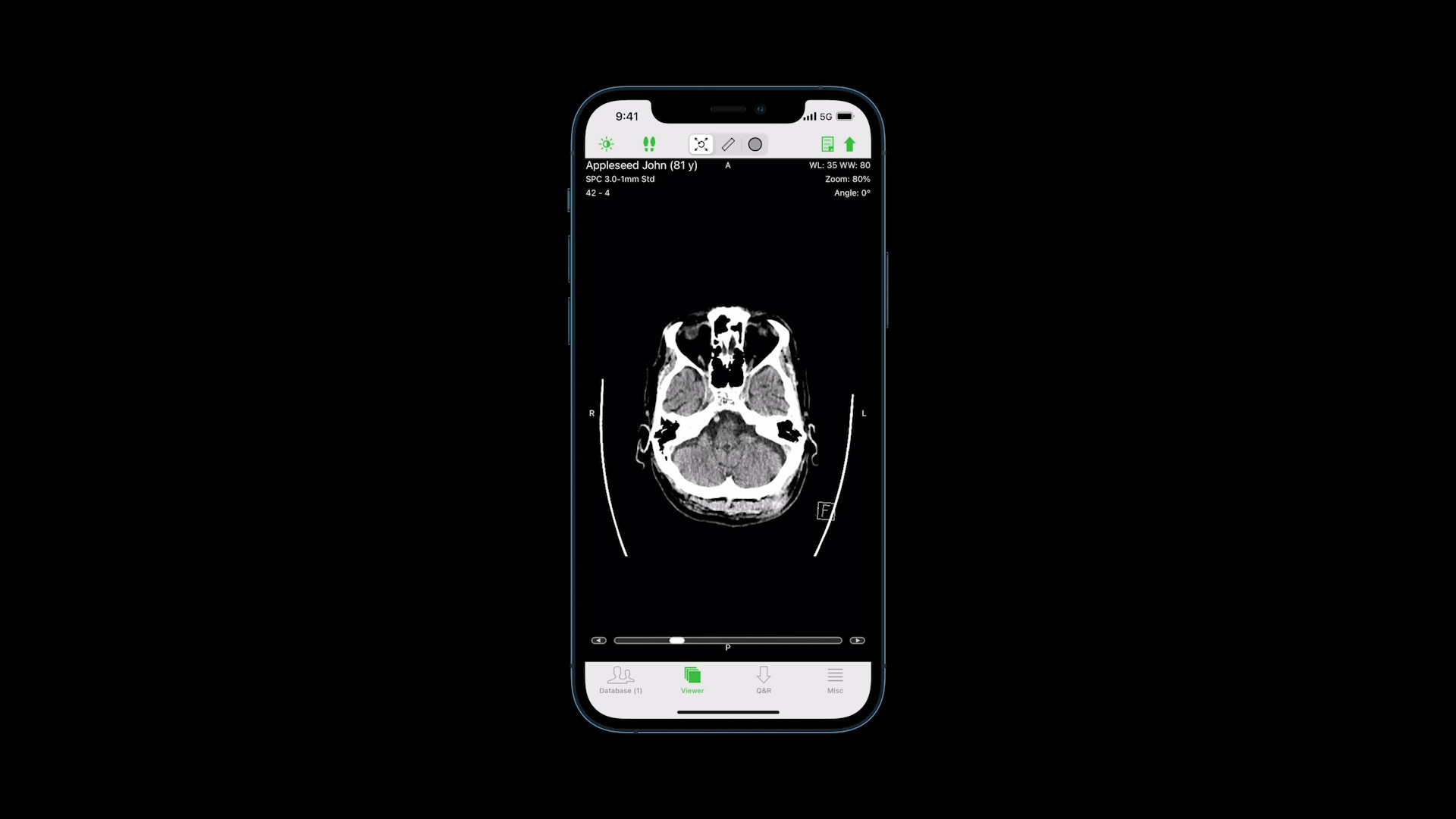 iphone screen medical scan