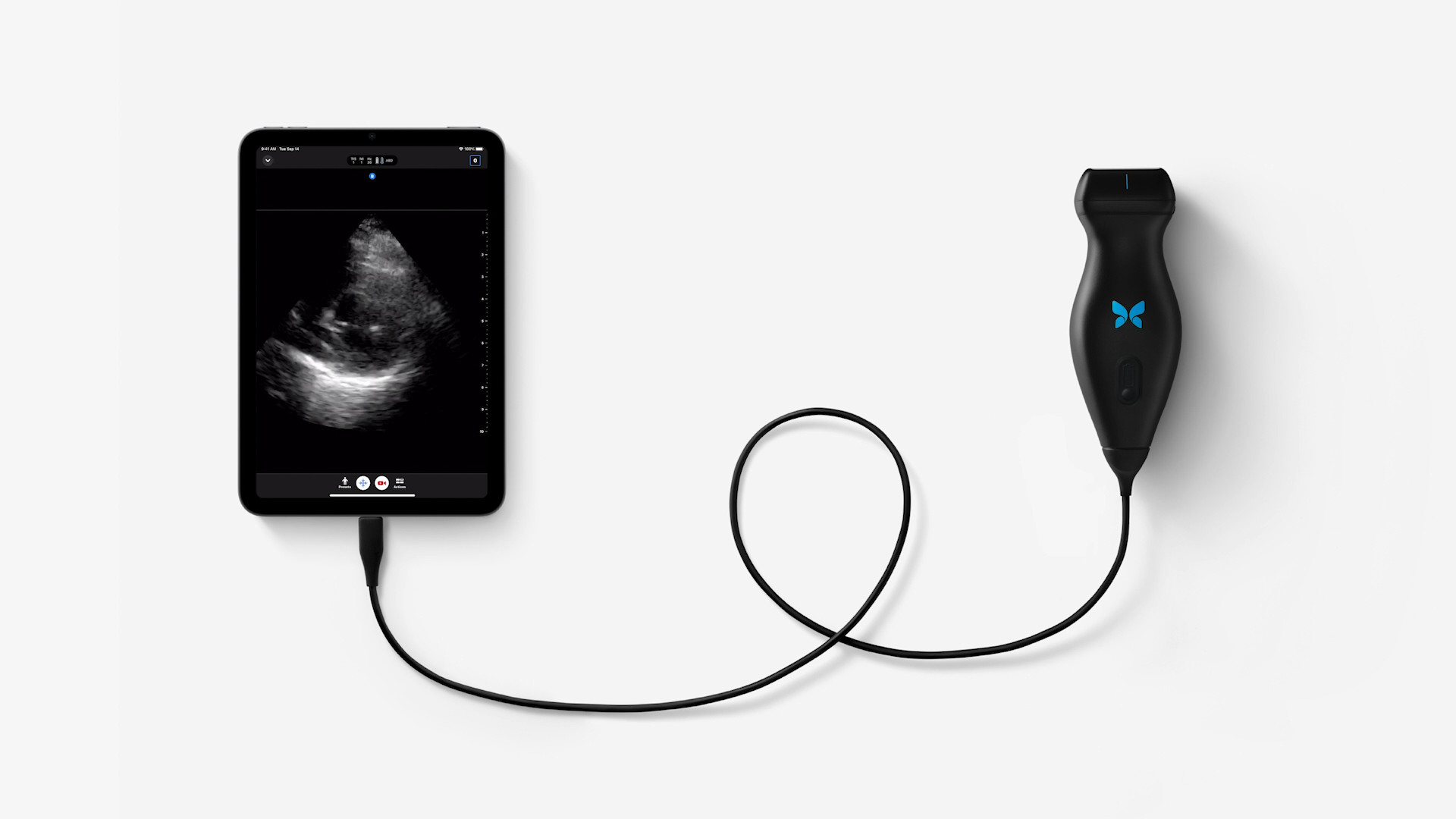 tablet ultrasound connection