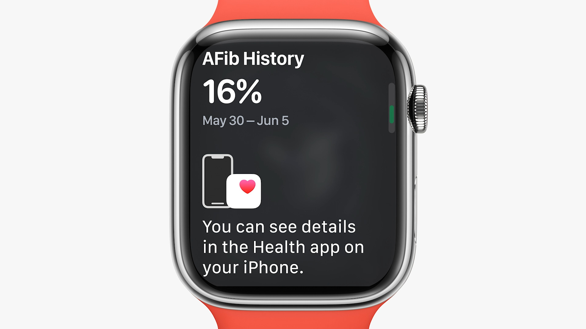 afib history details