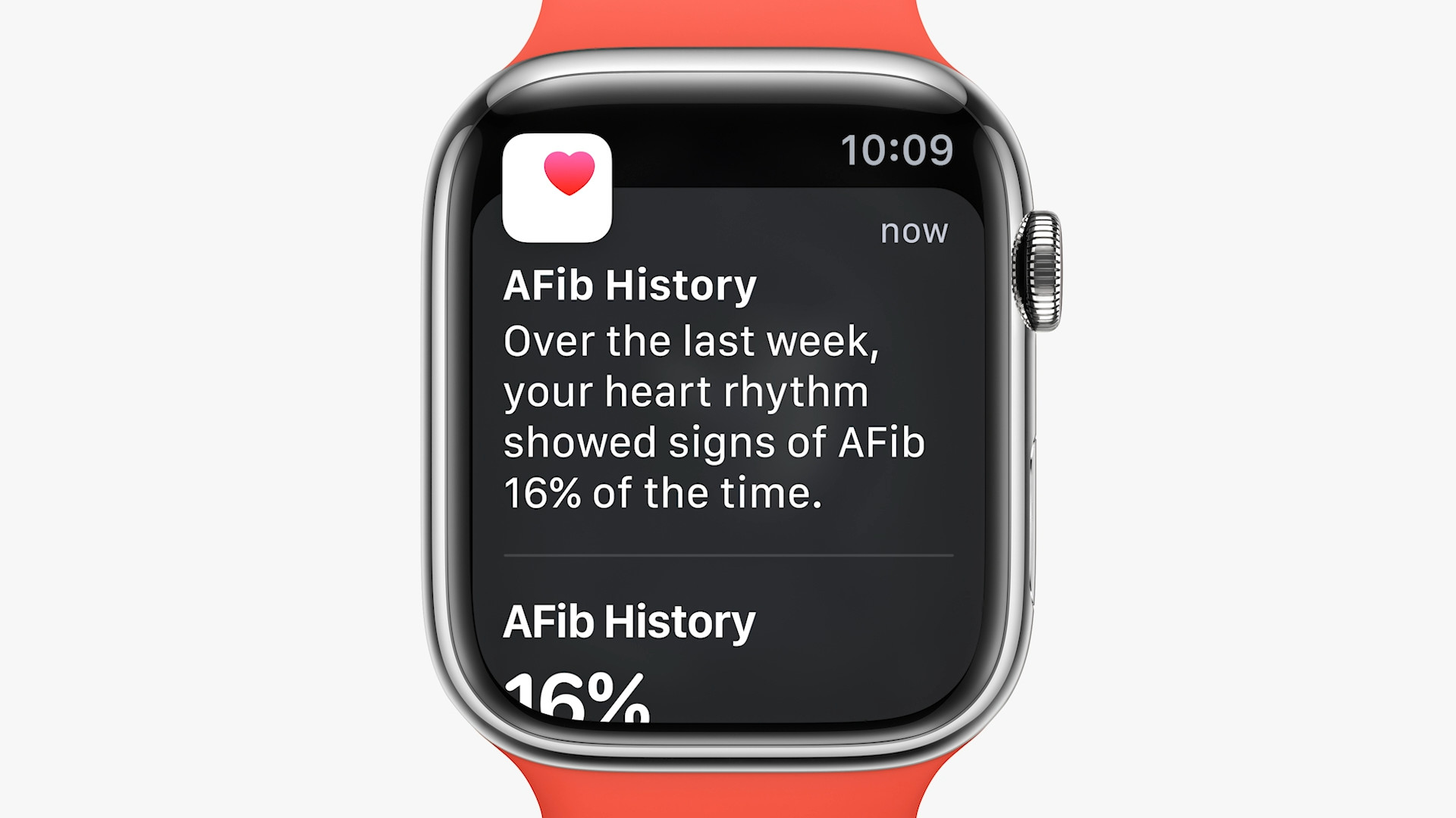 afib history notification