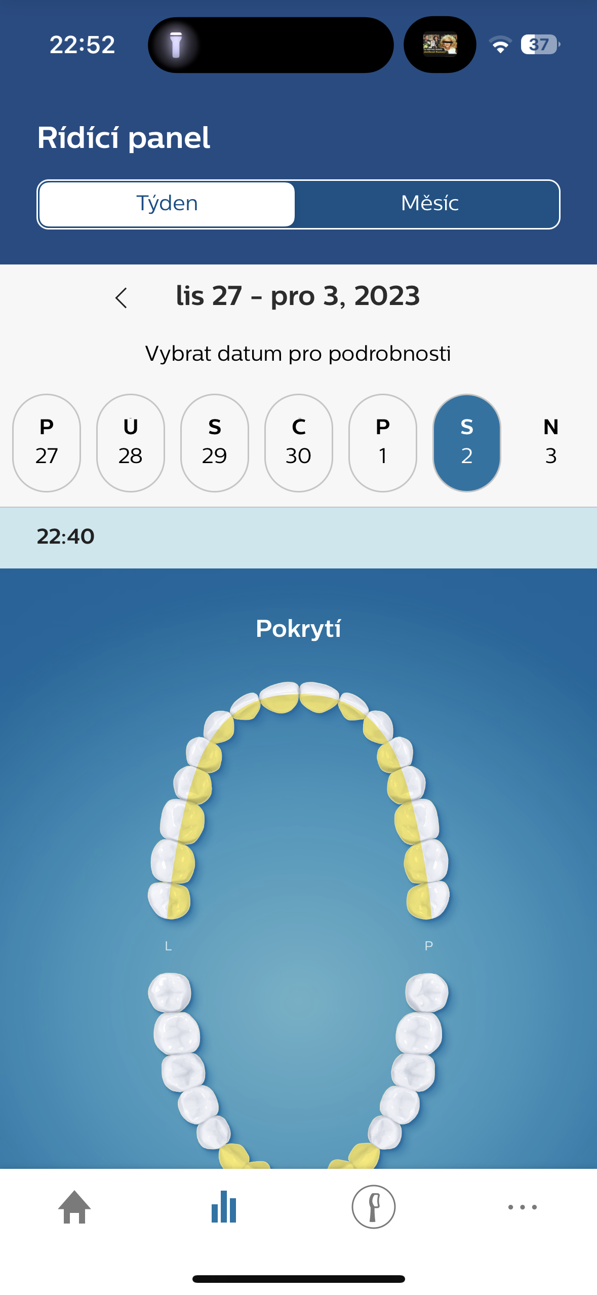 dental brush settings
