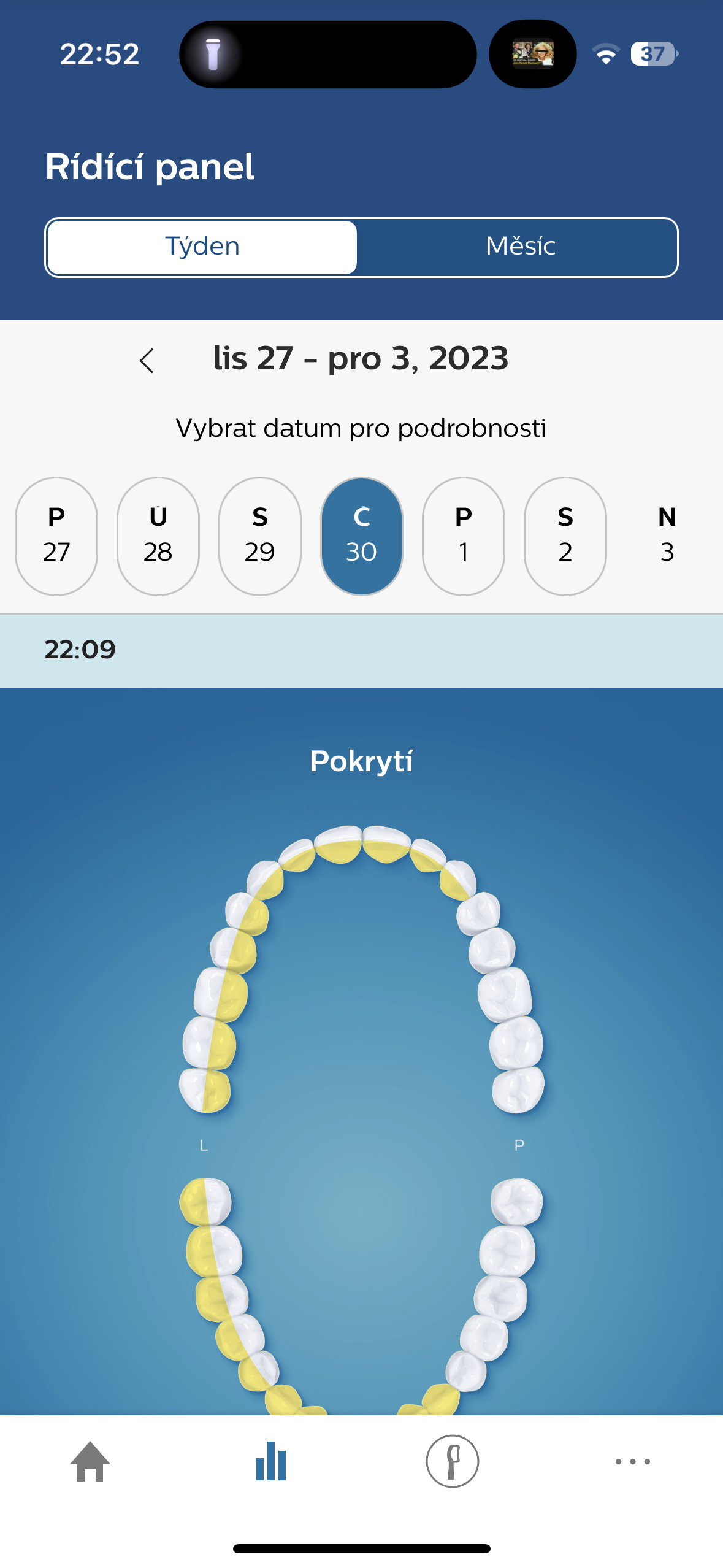 dental coverage visualization