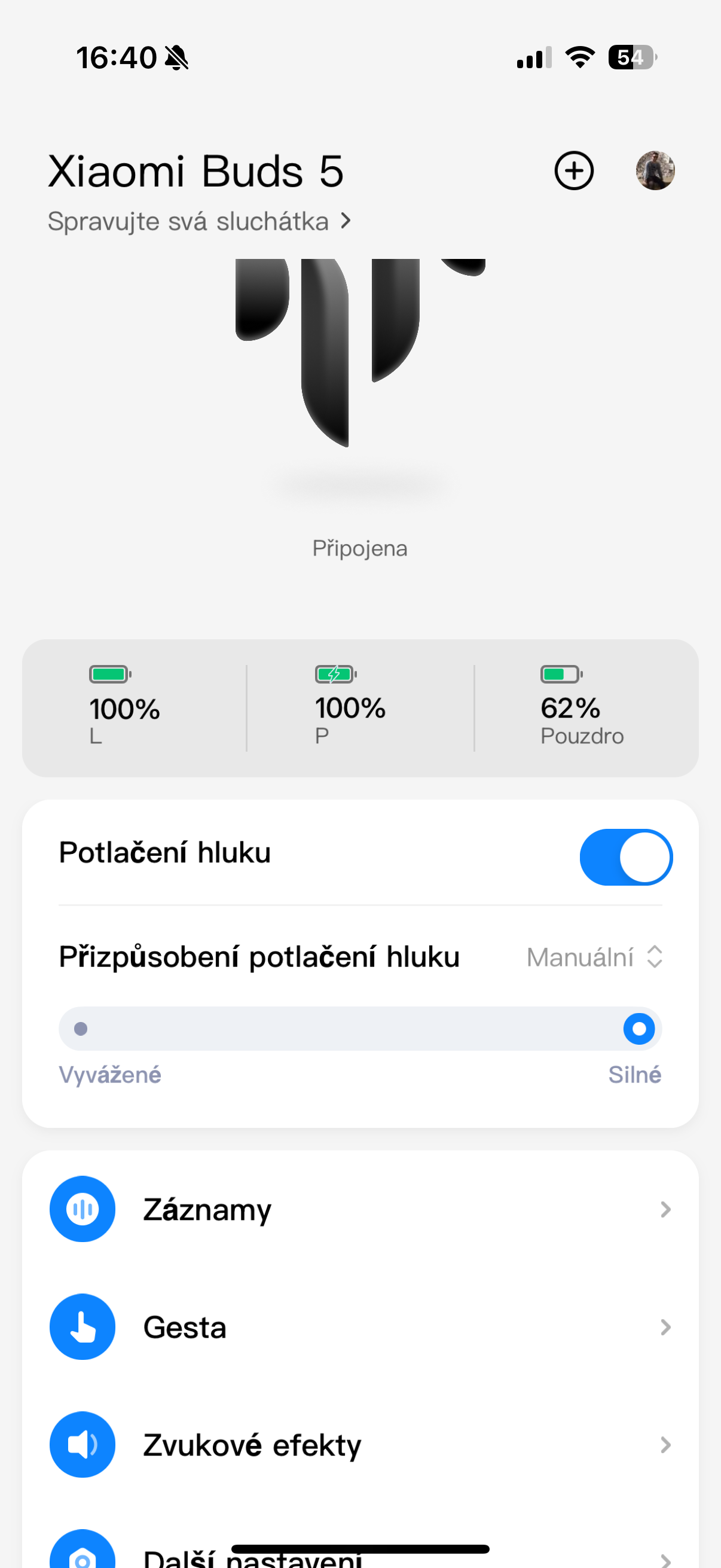 xiaomi buds 5 noise cancellation