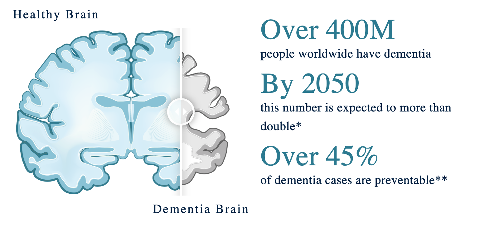 healthy vs dementia brain
