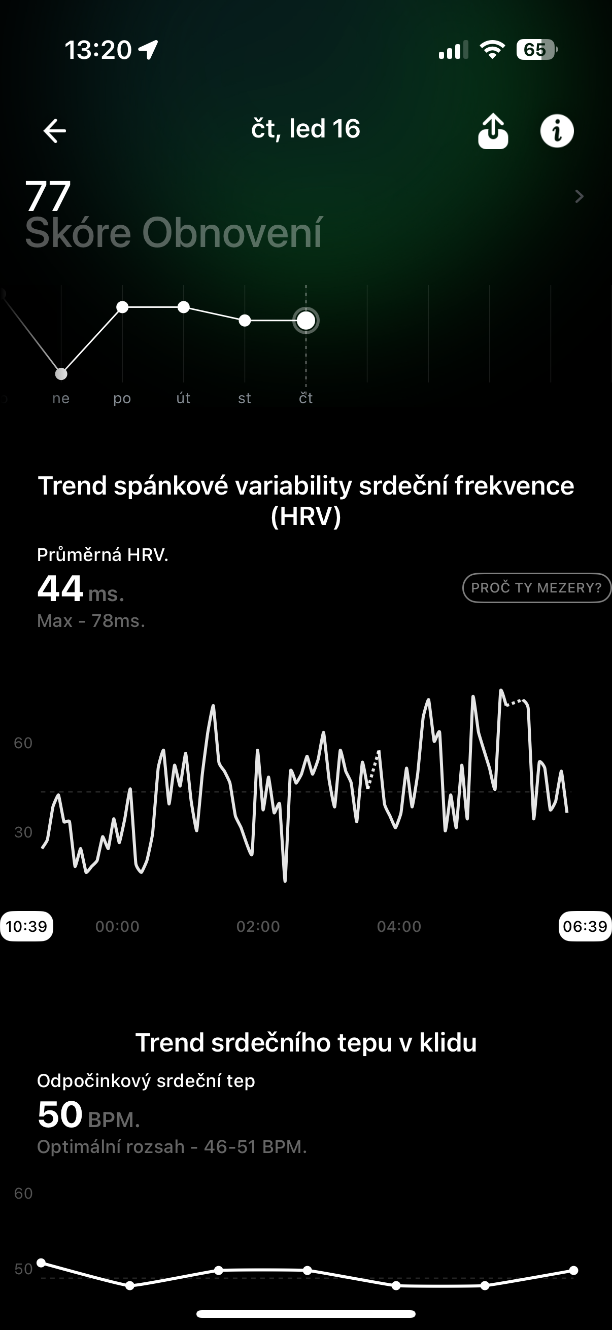 hrv variability trend