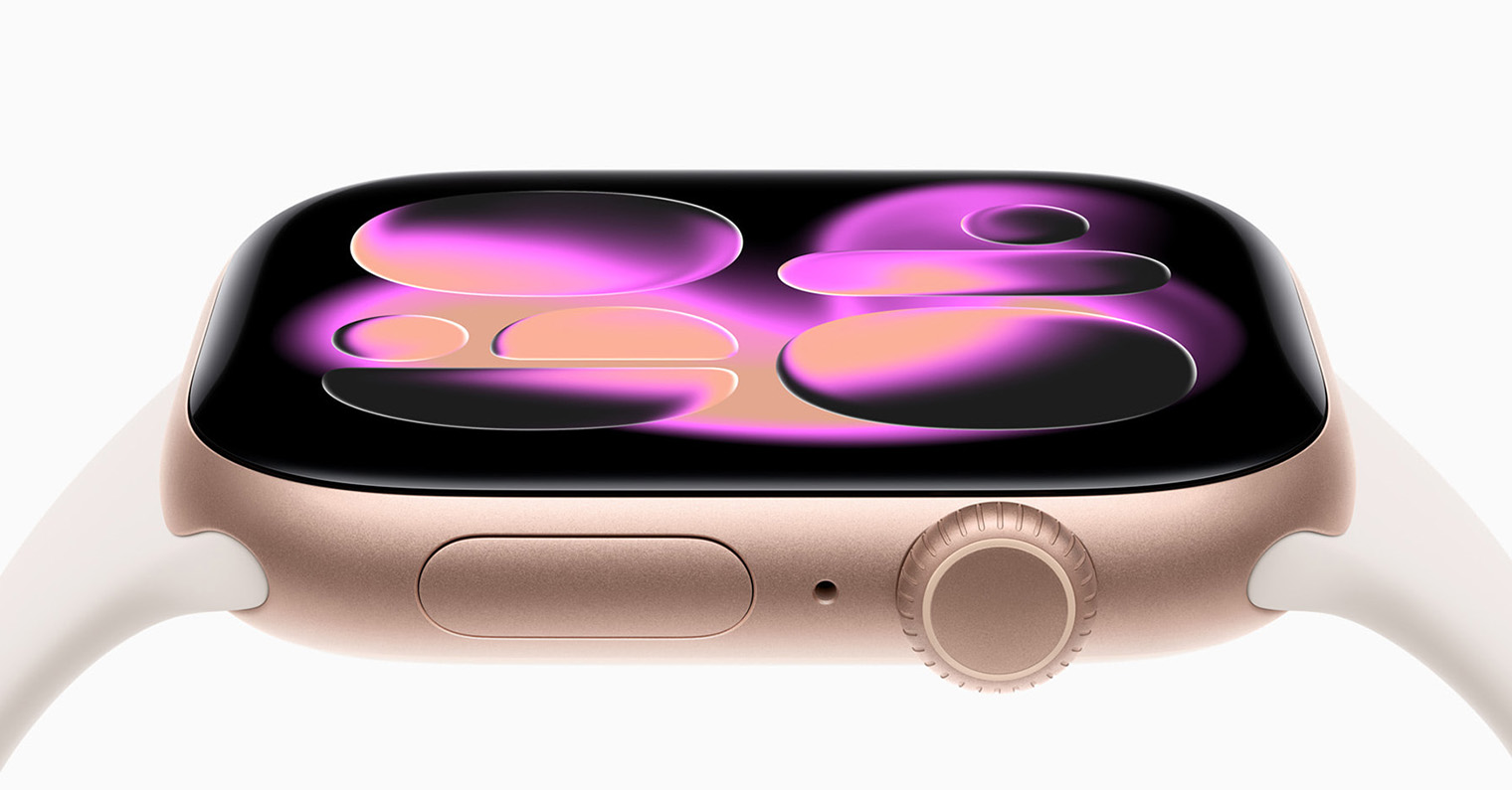 Apple Watch Series 11 1520x794